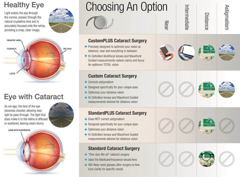 Same Day Cataract Surgery, Progressive Lens Designs, and the Top Eye Care  News